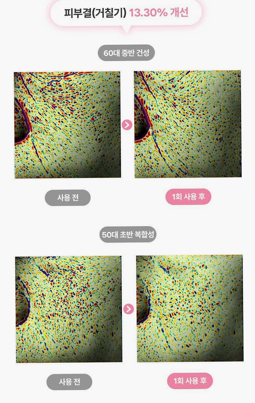 펄리 엑소좀 피부과재생크림 수분 보습 시카 히알루론산 물광크림 40ml, 1개